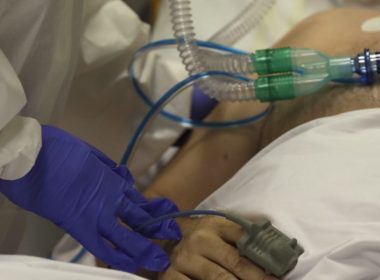 Pacientul cu arsuri grave transferat cu întârziere în Belgia a murit