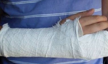 Un chirurg din Cluj, condamnat penal, este acuzat de malpraxis, după ce a pus greşit mâna unei fetiţe în ghips