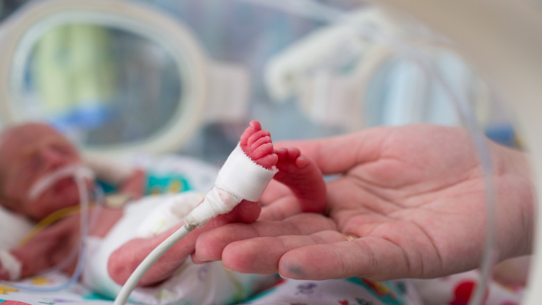 Cel mai mic bebeluş născut prematur, sub 500 de grame