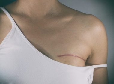 Lecţii gratuite de autopalpare a sânilor. Campanie de prevenire a cancerului mamar