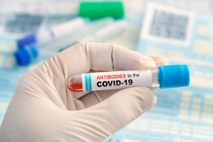 De ce testele de anticorpi sunt deocamdată irelevante pentru a determina în ce măsură suntem protejaţi de coronavirus