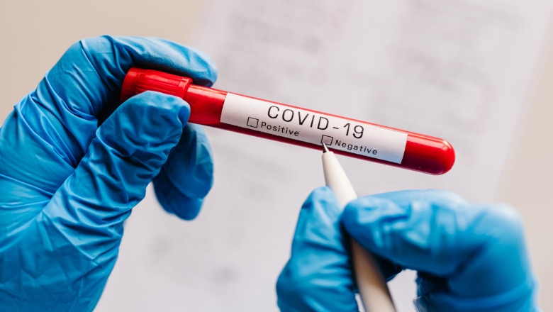Numărul cazurilor zilnice de COVID-19 nu scade sub pragul de 100