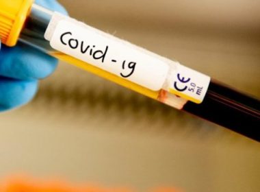 Primul caz de coronavirus confirmat în Satul Olimpic din Tokyo, înaintea deschiderii Jocurilor Olimpice 2021