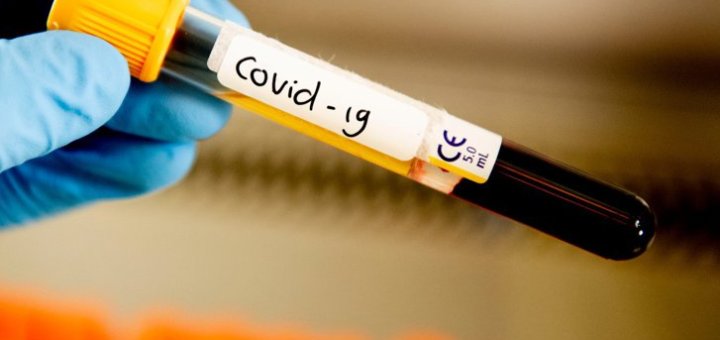 Primul caz de coronavirus confirmat în Satul Olimpic din Tokyo, înaintea deschiderii Jocurilor Olimpice 2021