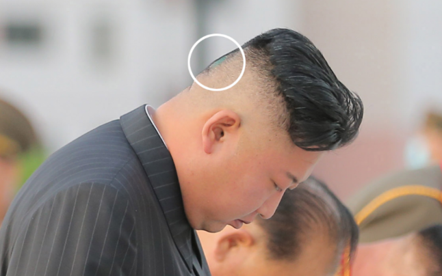 Bandajul de pe ceafa lui Kim Jong Un, ultimul mister de pe lista posibilelor probleme de sănătate ale liderului nord-coreean