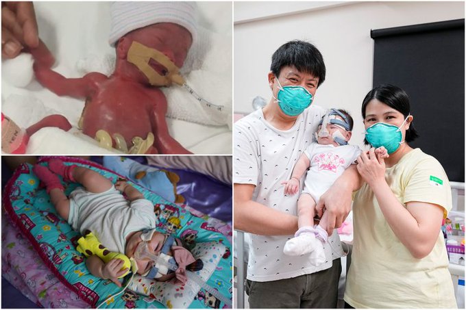 Cel mai mic bebeluş din lume, externat după 13 luni de spitalizare