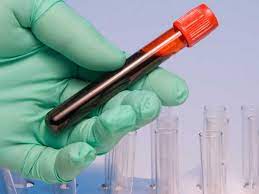 Marea Britanie demarează studiul clinic al unui test de sânge care poate detecta 50 de tipuri de cancer