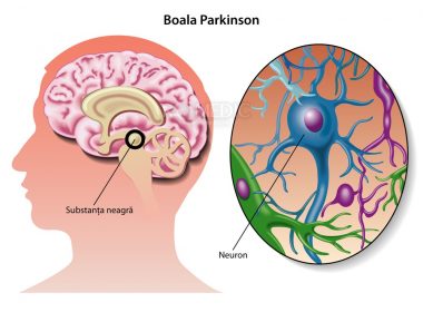 Ziua mondială de luptă împotriva bolii Parkinson