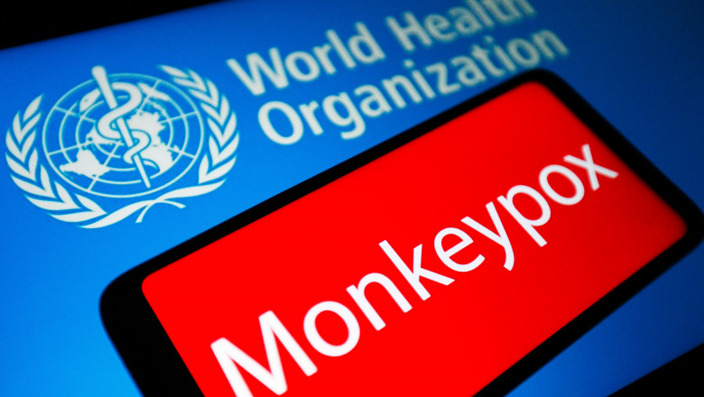 Variola maimuţei: Noi cazuri detectate zilnic în Marea Britanie 